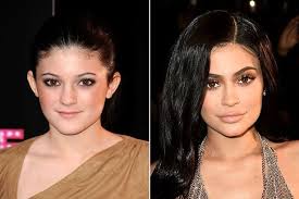 She starred in the e! 9 Kylie Jenner Transformation Ideas Kylie Jenner Transformation Kylie Jenner Nose Job