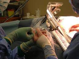 It is composed of different biological matrices such as circulating tumor cells (ctcs), cell free nucleic acids, exosomes or t … Biopsy Wikipedia