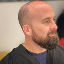 A traditional buzz cut is very short and identified by hair that is clipped very close to the head with a razor. Balding The Signs And How To Stop Balding Prevent Baldness