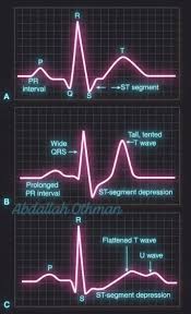 Image result for U Wave