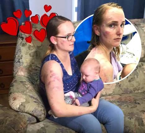 AUSTRALIAN MOM USES HER BODY TO PROTECT HER BABY DURING AN EXTREME HAIL  STORM ⛈️