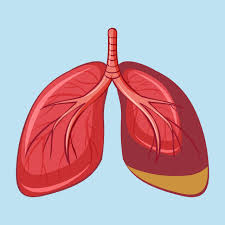 Call by telephone first, if you can and follow the directions of your local health. How Does Mesothelioma Affect The Body Pintas Mullins Law Firm