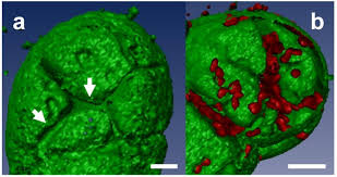 Plant cells have large vacuoles each surrounded by a membrane what is the name of this membrane. New Insights Into The Tonoplast Architecture Of Plant Vacuoles And Vacuolar Dynamics During Osmotic Stress Bmc Plant Biology Full Text