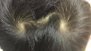 images?q=tbn:ANd9GcR_qhR0_Dp_oXufhElO47i