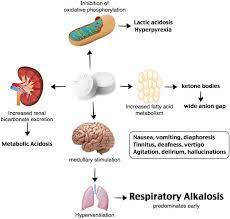 Rosh Review Respiratory Alkalosis Metabolic Acidosis Metabolic Alkalosis