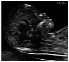 Aium Practice Guideline For The Performance Of Obstetric Ultrasound Examinations 2013 Journal Of Ultrasound In Medicine Wiley Online Library