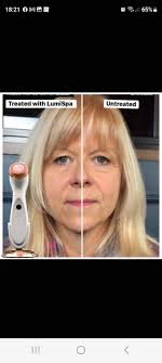 🧡 The Better Together Kit, and just take a little peak at the results with  this device 💙 This package includes the Beauty Focus Collagen Plus and  ageLOC Boost System that are