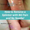 Your well articulated article left me with much good i was astounded to find my splinter in a finger was so large and looking for signs of infection. 1