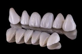 Crown plateform offers specific research, development and production functionalities via nfts. All Ceramic And Veneer Digital Esthetic Solutions