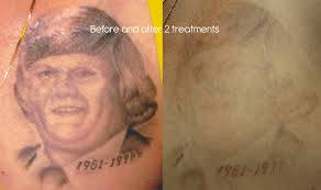 We hope to see you all there and can't thank everyone involved enough for all their support! Bombshell Tattoo Removal Posts Facebook