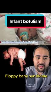 Image result for Infant Botulism