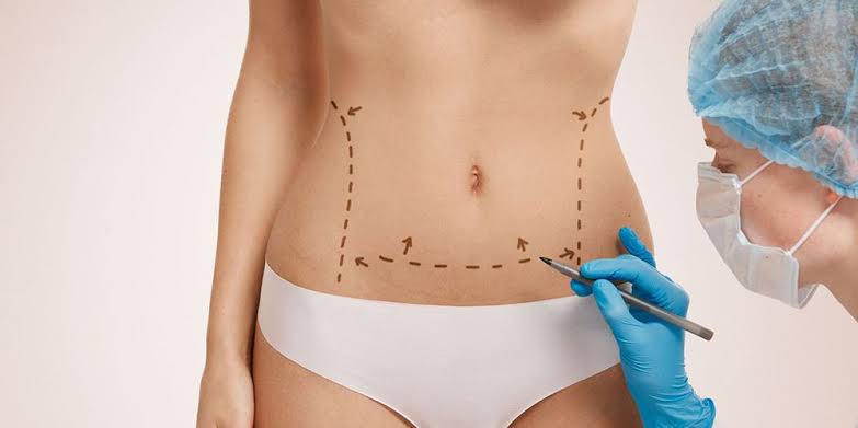 Best Tummy Tuck Surgery in Islamabad