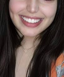 Dimple Girl ✨✨🌸