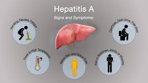 Image result for hepatitis symptoms