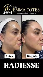 Te cuento sobre mi rutina de skincare cuando viajo 🧴✈️ Aunque esté lejos  de casa, nunca dejo de cuidar mi piel. Me enfoco en mantenerla hidratada,  protegida del sol y fresca durante