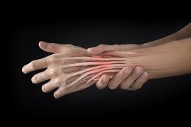 It contains both flexor tendon superficialis and flexor tendon profundus. Extensor Tendonitis Causes Recovery And Prevention