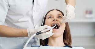 Scaling and Polishing Process - Smile Vizag Dental - Smile Vizag Dental