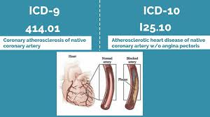 Pin On Icd9 To Icd10 Transition Codes