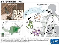 Sources Of Histoplasmosis Types Of Diseases