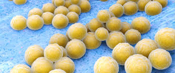 Aureus) die symptome sind daher ebenfalls vergleichbar. Ratgeber Wunde Mrsa Symptome Und Erkennungszeichen