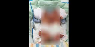 Video kali ini kita membahas tentang apa itu hamil kembar, kenapa seorang wanita bisa mendapatkan kehamilan kembar 7 Ciri Ciri Hamil Anak Kembar Yang Bisa Anda Kenali Sejak Awal Merdeka Com