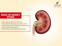 Are You At Risk Of Developing Kidney Stone Know What Makes You More Susceptible To It Dial 91 Inflammatory Bowel Syndrome Laparoscopic Surgery Kidney Stones
