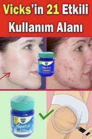 Vicks Krem Nedir Ne Ise Yarar Faydalari Ve Fiyati Cilt Bakimi Vicks Vicks Vaporub Vicks Vaporub Uses