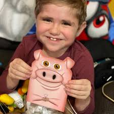 19- year -old Catholic boy Alex Polifka from San Diego, who recently passed  away after battling a rare cancer for 5 years that even affected his face,  touched many lives through the