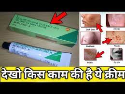 à¤¦ à¤ Betnovate N à¤ à¤° à¤® à¤ à¤¹ à¤° à¤¨ à¤à¤°à¤¨ à¤µ à¤² à¤ª à¤° à¤¸à¤ à¤ à¤ Betnovate N Cream Review Sg Support Youtube Find here online price details of companies selling anti pimple cream. betnovate n cream review