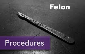 Image result for Felon