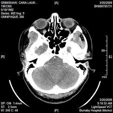 Learn vocabulary, terms, and more with flashcards, games, and other study tools. Us Department Of Health Human Services Usdhhs Flashcards Quizlet