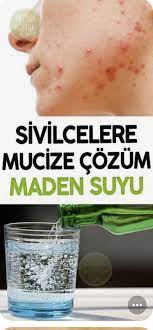 Maden Suyunun Cilde Faydalari Yuze Maden Suyu Yuze Surulur Mu Cilt Bakimi Dogal Saglik Dogal Guzellik Ipuclari Dogal Cilt Bakimi