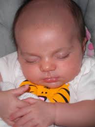 At about 2 months old my baby lost his hair around the side of his head which has grown back slightly. Newborn Hair Loss Relentless Enthusiasm