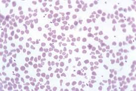 Animal red blood cell diagram labeled. Red Blood Cells In Animals Circulatory System Veterinary Manual