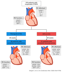 Image result for Afterload