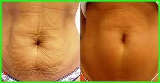 Pin On Simple Weight Loss Tips