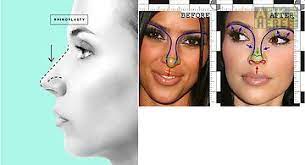 **do you want the most awesome nose ever?****try this virtual nose job and rhinoplasty simulator! Nose Job Me For Android Free Download At Apk Here Store Apktidy Com