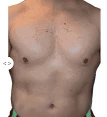 The ipl hair removal for women, permanent laser hair removal 999,900 flashes, at home use painless hair remover on bikini. Hair Removal For Men 600 000 Flashes Of Lifetime Use Best Home Ipl Skin N Sleek