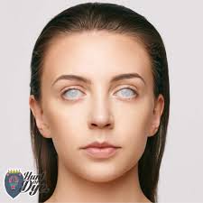 A lens is a transmissive optical device that focuses or disperses light beams by means of refraction. Mesmereyez Fancy Dress One Day Contact Lenses White Mesh