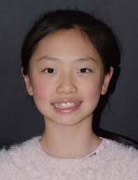 iOrthoPredictor model-guided deep prediction of teeth alignment YANG,  Lingchen; SHI, Zefeng; WU, Yiqian; LI, Xiang; ZHOU, Kun; F