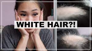 I'm not sure if it will regain colour or whether i now have poliosis in the regrowth area. Hair Growing Back White Tructd Youtube