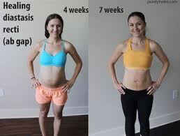 Pin On Pregnancy And Labor