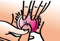 Couchée, assise, ou debout avec le bras posé sur une femidom, female condom, preservatif feminin : Memoire Online Utilisation Des Preservatifs Dans La Lutte Contre Les Ist Et Vih Sida En Milieu Universitaire Marcel Bahati Rusimbuka