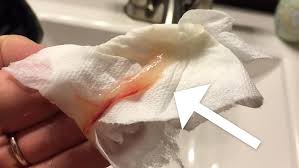 Pemilihan bahan bangunan yang tepat merupakan hal yang penting. Pink Mucus 7 Weeks Pregnant Vaginal Discharge During Pregnancy Parents Yesterday When I Went To The Toilet There Was A Tiny Amount Of Blood On My Knickers But There Was