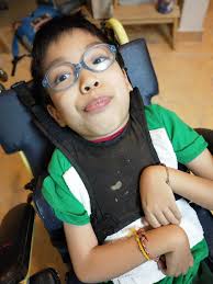 If the thought crossed your mind to poke Dr. Maxfield's other eye!