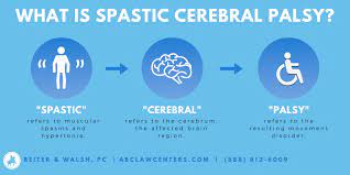 Signs and symptoms vary between people. Cerebral Palsy Lawyers Legal Help For Cp Cases