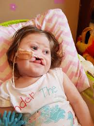 Cleft Lip & Palate Association