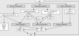 Image result for Preload