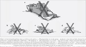 Figure 5 from [POSSIBILITIES AND LIMITATIONS OF SEXUAL ACTIVITY FOLLOWING  TOTAL HIP REPLACEMENT]. | Semantic Scholar