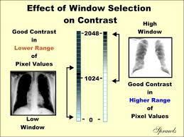 Digital Image Processing